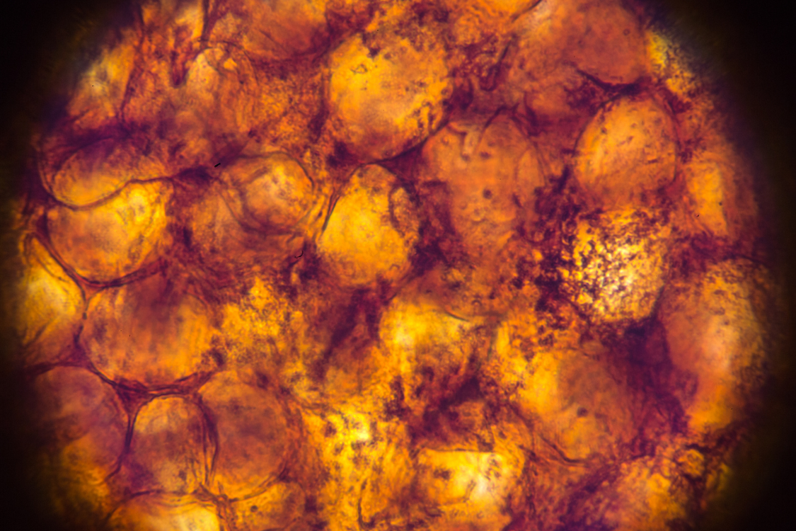close up magnified image of brown adipose tissue